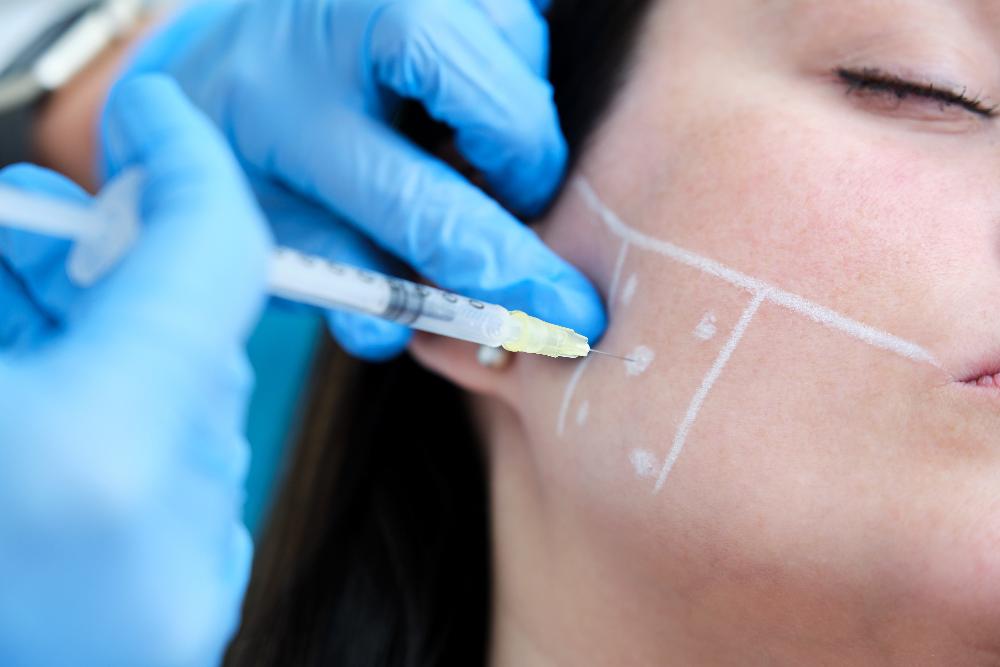 Woman getting botox injections from dentist to treat her bruxism
