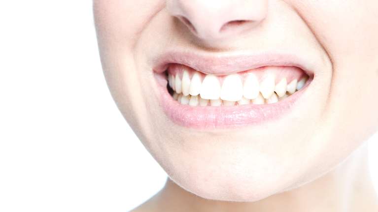 Woman smiling showing her straight teeth