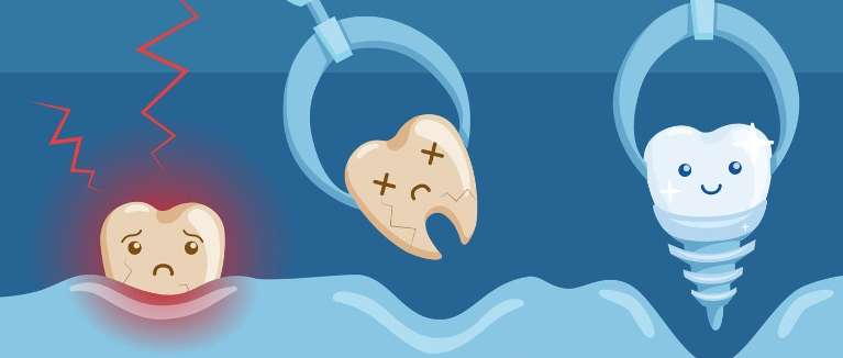 Graphic illustration representing a dental surgery procedure