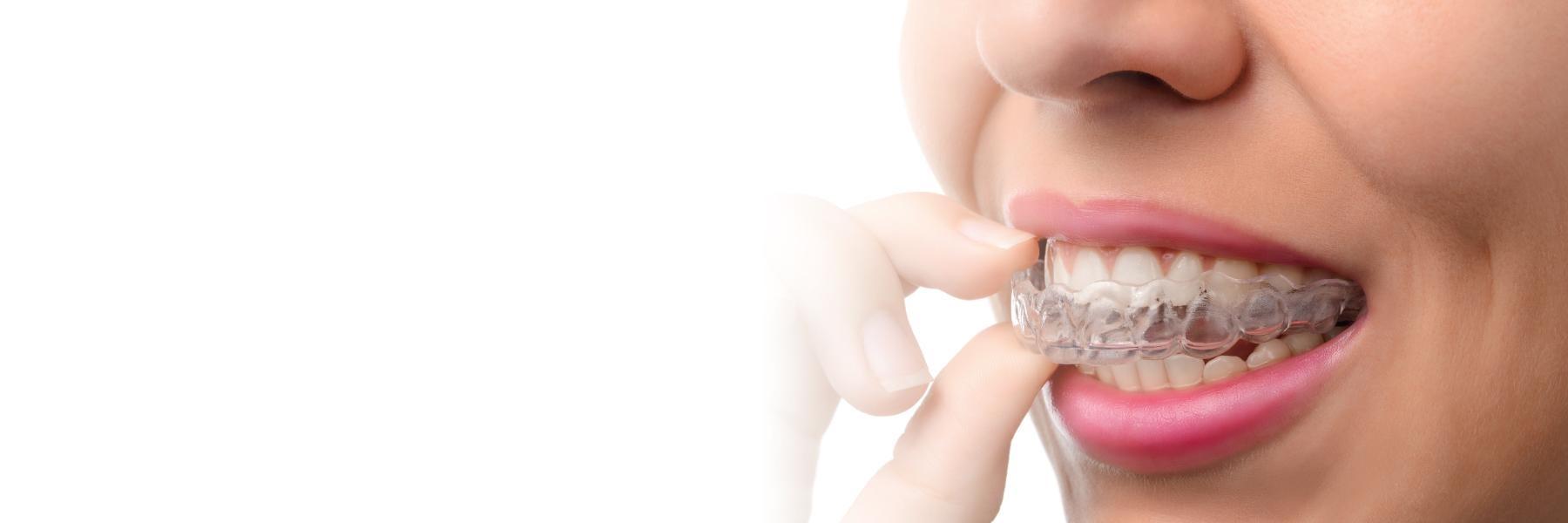 Invisalign Dentist | Woman using Invisalign | Paddington Dentistry